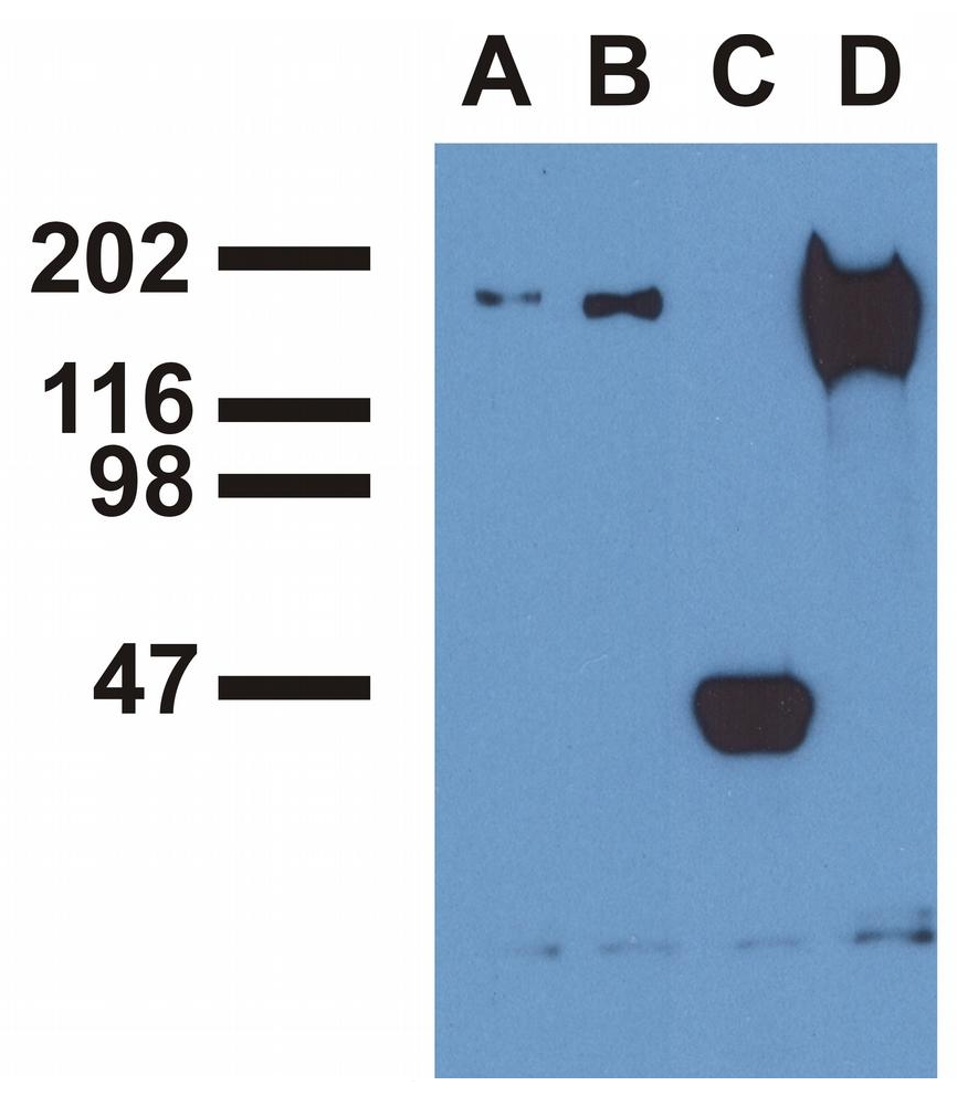 EGFR (phospho-Tyr1173) antibody