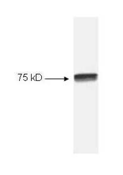 NFkB Antibody Sampler Kit