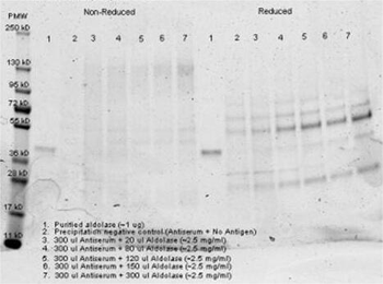 Aldolase antibody