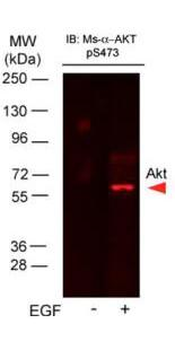 Akt (phospho-S473) antibody