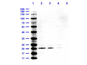 IL6 antibody (Peroxidase)