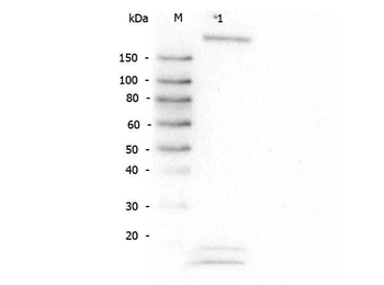 ROBO-1 antibody