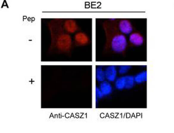 CASZ1 antibody