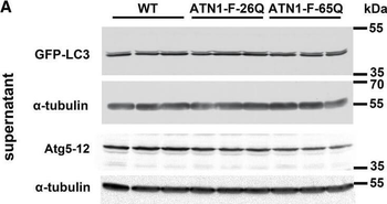 ATG13 (phospho-S318) antibody