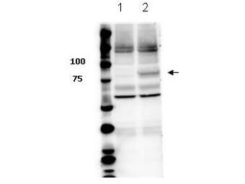 STAT3 (phospho-Y705) antibody