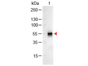 RABBIT IgG (H&L) antibody (Alkaline Phosphatase)