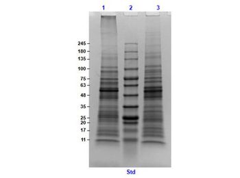 Normal Mouse Pancreas Whole Cell Lysate