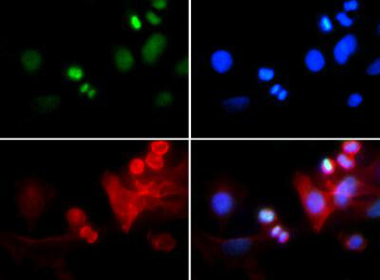 Histone H3 K4me3/pT6 antibody