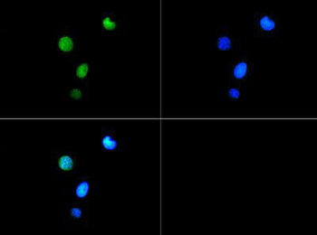 Histone H3 K9me3/pT6 antibody