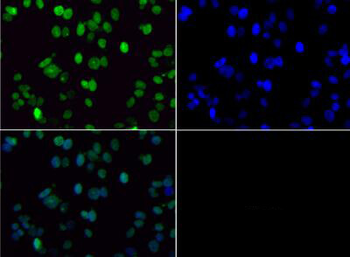 Histone H3 K36me2 antibody