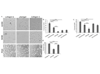 Human Collagen Type VI protein