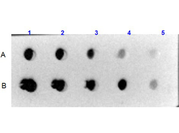 Human Collagen Type VI protein