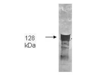 glpK antibody