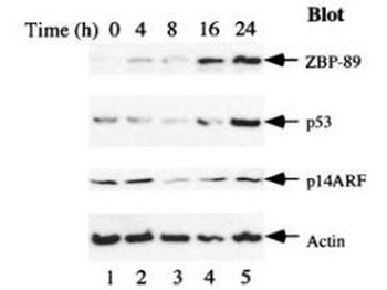 ZNF148 antibody