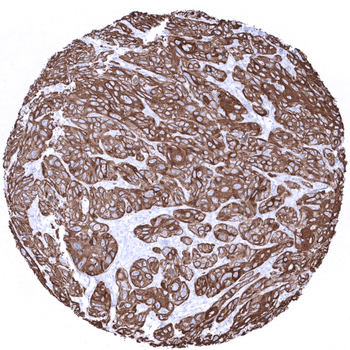 Cytokeratin 6 antibody