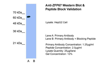 ZBTB7B antibody