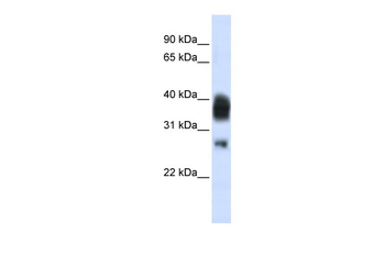 RNASEH1 antibody