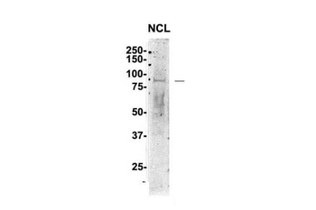 NCL antibody