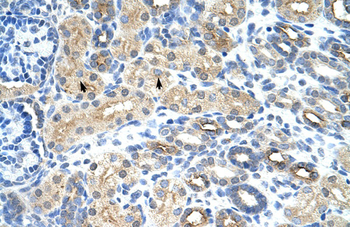 SNRNP35 antibody