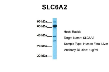 SLC6A2 antibody