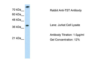TST antibody