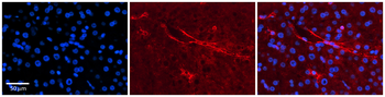 SLC5A5 antibody