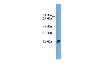 SLC5A5 antibody