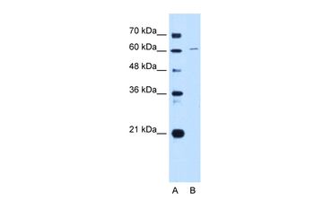 CDT1 antibody