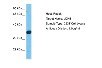 LDHB antibody