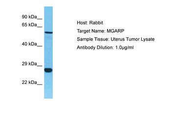 MGARP antibody