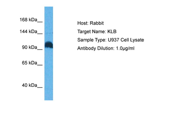 KLB antibody