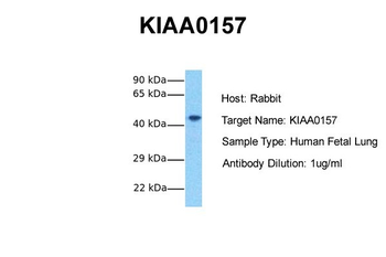 FAM175B antibody