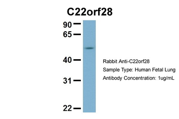 RTCB antibody