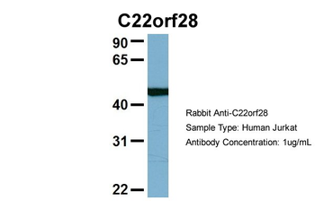 RTCB antibody