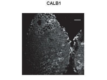 CALB1 antibody