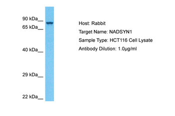NADSYN1 antibody