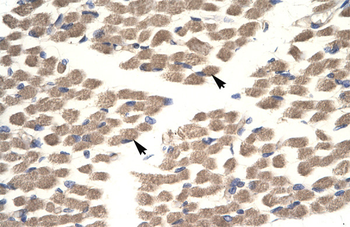 POU2F3 antibody