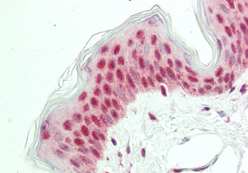 POU2F3 antibody