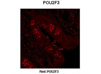 POU2F3 antibody