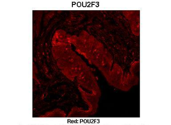 POU2F3 antibody