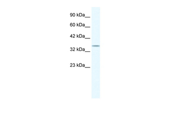 POU2F3 antibody