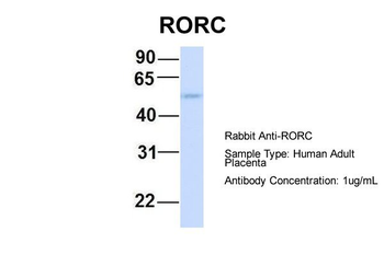 RORC Rabbit Polyclonal Antibody