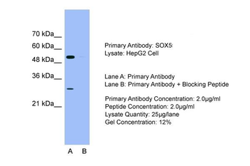 SOX5 antibody