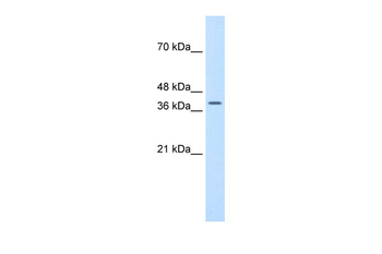 TFB2M antibody