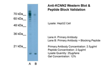 KCNN2 antibody