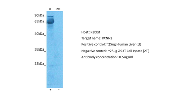 KCNN2 antibody