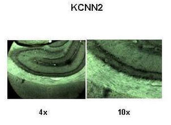 KCNN2 antibody