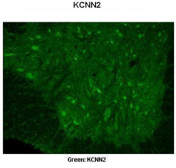 KCNN2 antibody