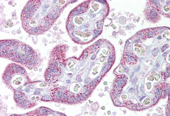 TRPC4 antibody