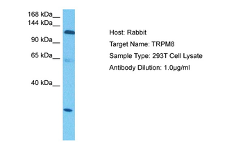 TRPM8 antibody